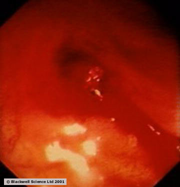 download imaging phonons